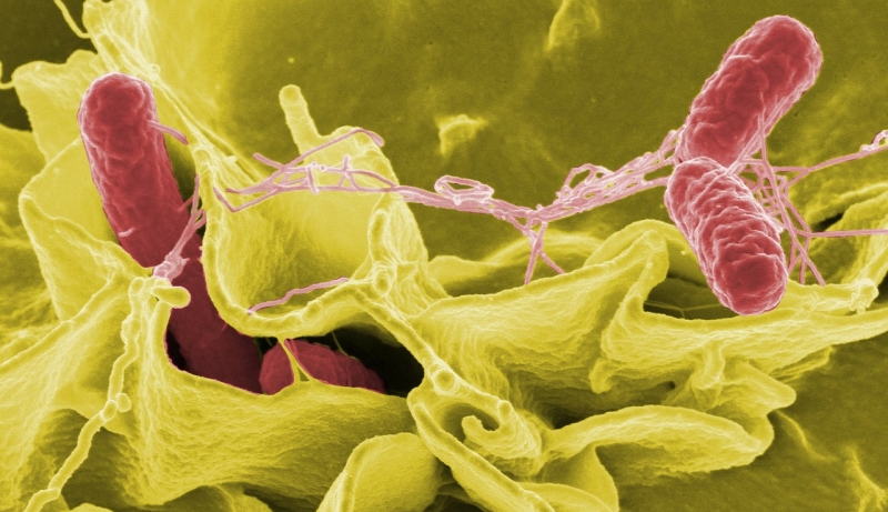 サルモネラ菌の電子顕微鏡写真