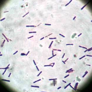 乳酸菌の顕微鏡写真